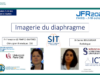 Imagerie du diaphragme