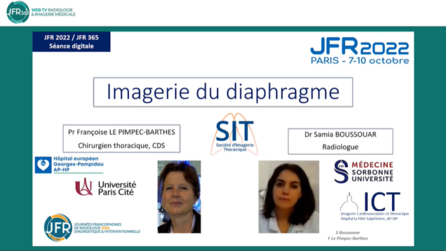 Imagerie du diaphragme