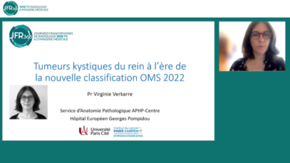 Tumeurs kystiques à l’ère de la nouvelle classification OMS 2022