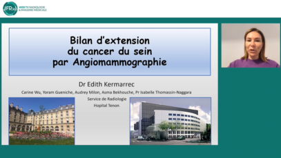 bilan d’extension du cancer du sein