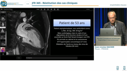 cas d’imagerie cardiauqe 2023