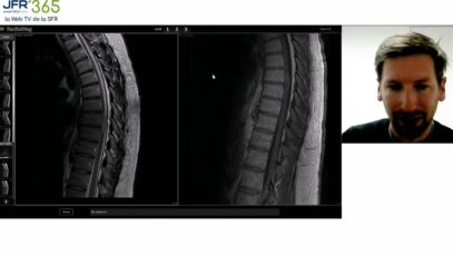 Cas clinique de neuroradiologie – Avril 2022