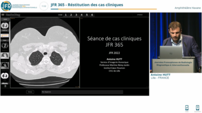 Cas clinique d’imagerie thoracique – Octobre 2022