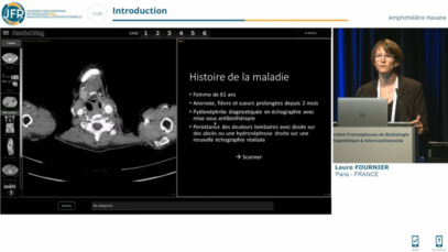 Cas clinique d’imagerie urologique – Octobre 2022