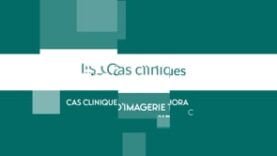 Cas clinique de Neuroradiologie – Octobre 2023