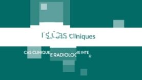 Cas Cliniques d’Imagerie Interventionnelle – Juin 2023