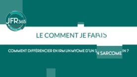 Comment différencier en IRM un myome d’un sarcome utérin?