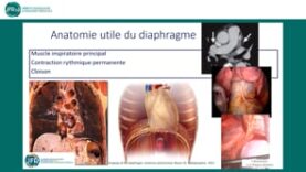 Imagerie du diaphragme