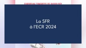 La SFR à l’ECR – Florian Nabet