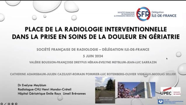Rôle de la RI dans la prise en soins de la douleur en gériatrie