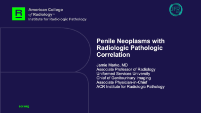 Capture d’écran 2025-10-31 163225