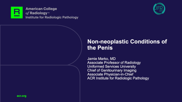 Capture d’écran 2025-10-31 164842