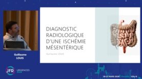 JFR Urgences – Diagnostic radiologique d’une ischémie mésentérique – Dr Guillaume LOUIS