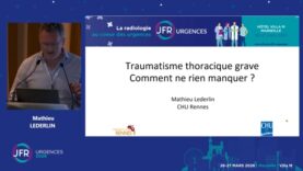 JFR Urgences – Traumatisme thoracique grave : comment ne rien manquer ? – Pr Mathieu LEDERLIN